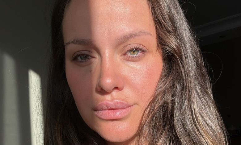 İrem Helvacıoğlu kaza sonrası açıklama yaparken