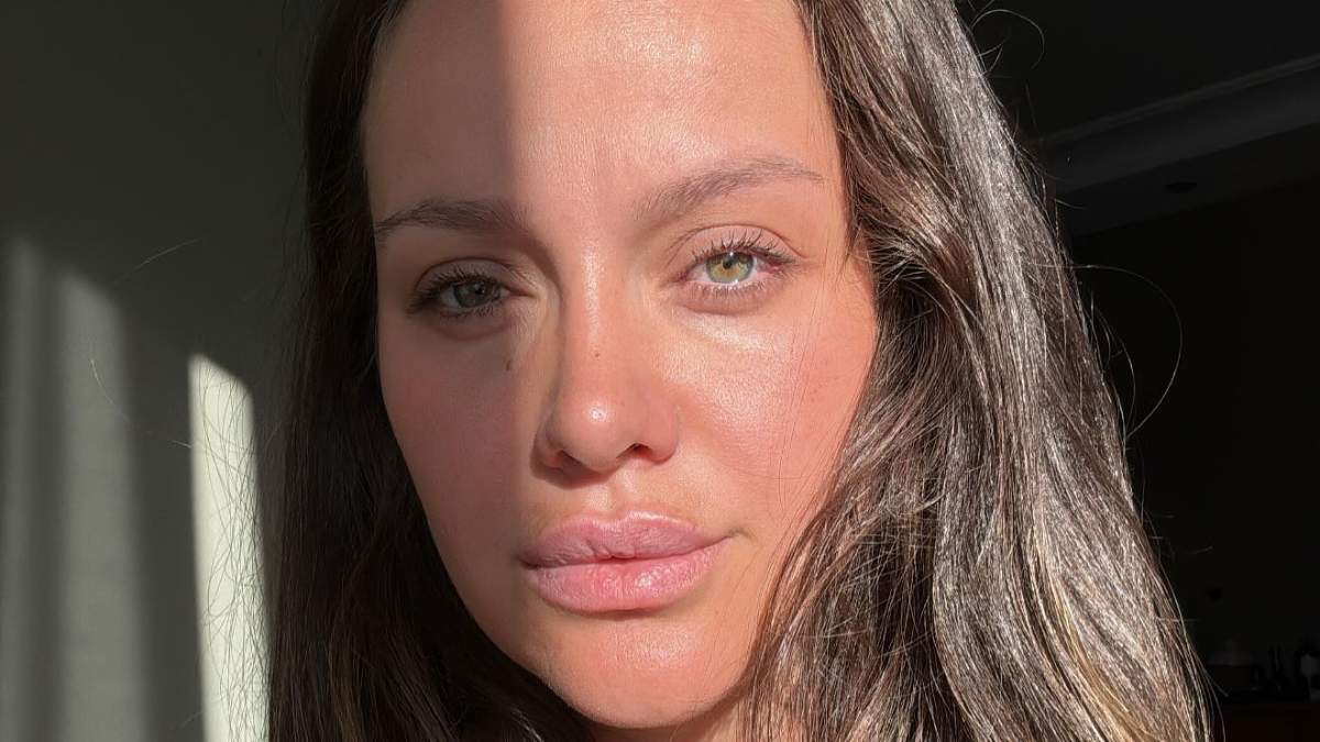 iremhelvacioglukazasonrasiilkpaylasim Negiyer Blog İrem Helvacıoğlu kaza sonrası açıklama yaparken