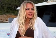 Nagihan Karaderenin yüzü şişmiş haliyle sosyal medya paylaşımı