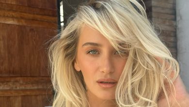 Manken Didem Soydan sosyal medyada estetik itiraflarını dile getiriyor